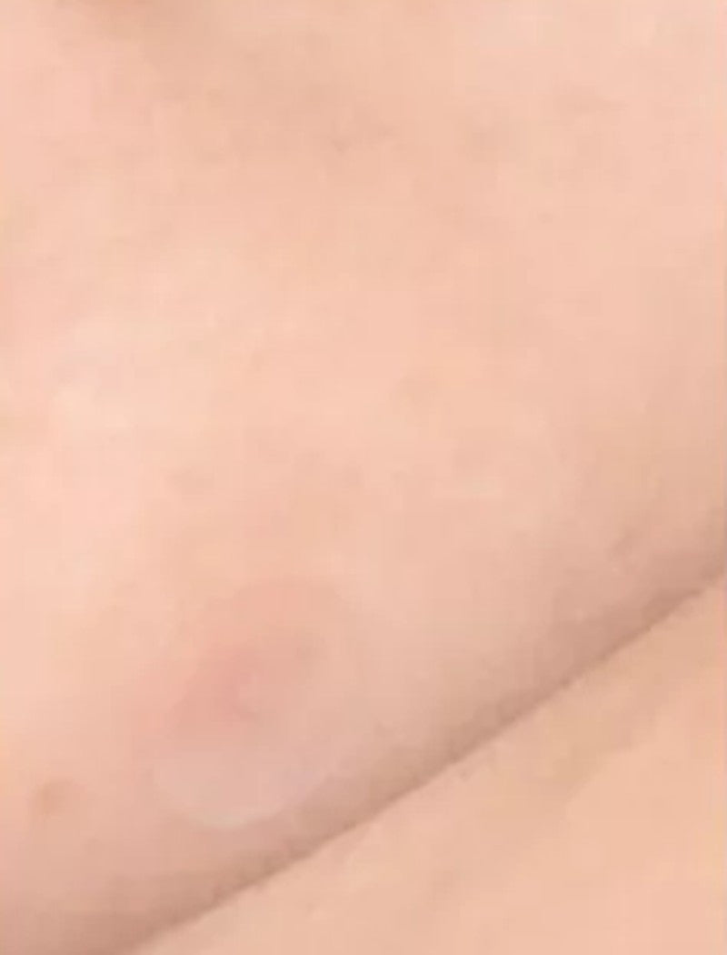 Ultra-thin patch barely visible on the skin