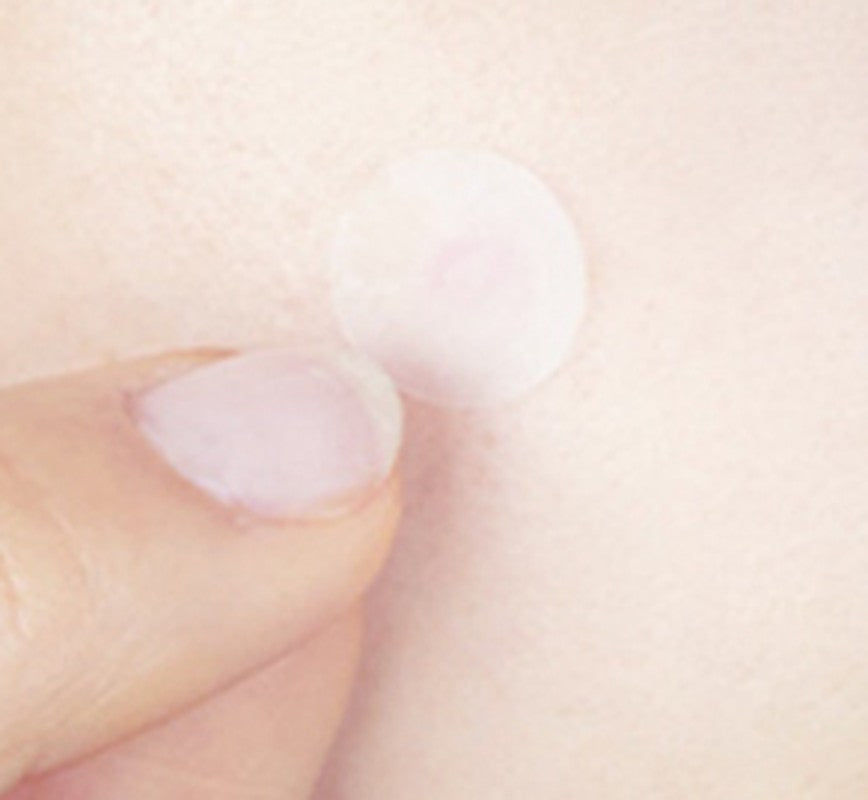 Fingertip pressing a clear patch onto the skin